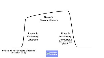 Capnography Waveforms: Normal Waveforms Explained