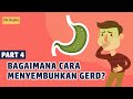 Bagaimana Cara Menyembuhkan GERD?