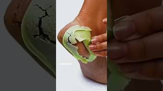 Easy Pedicure At Home/Get Rid of Dry &amp; Cracked Heels Repair #ytshorts #homeremedies #shorts#skincare