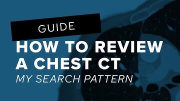 How to Review a Chest CT: My Search Pattern