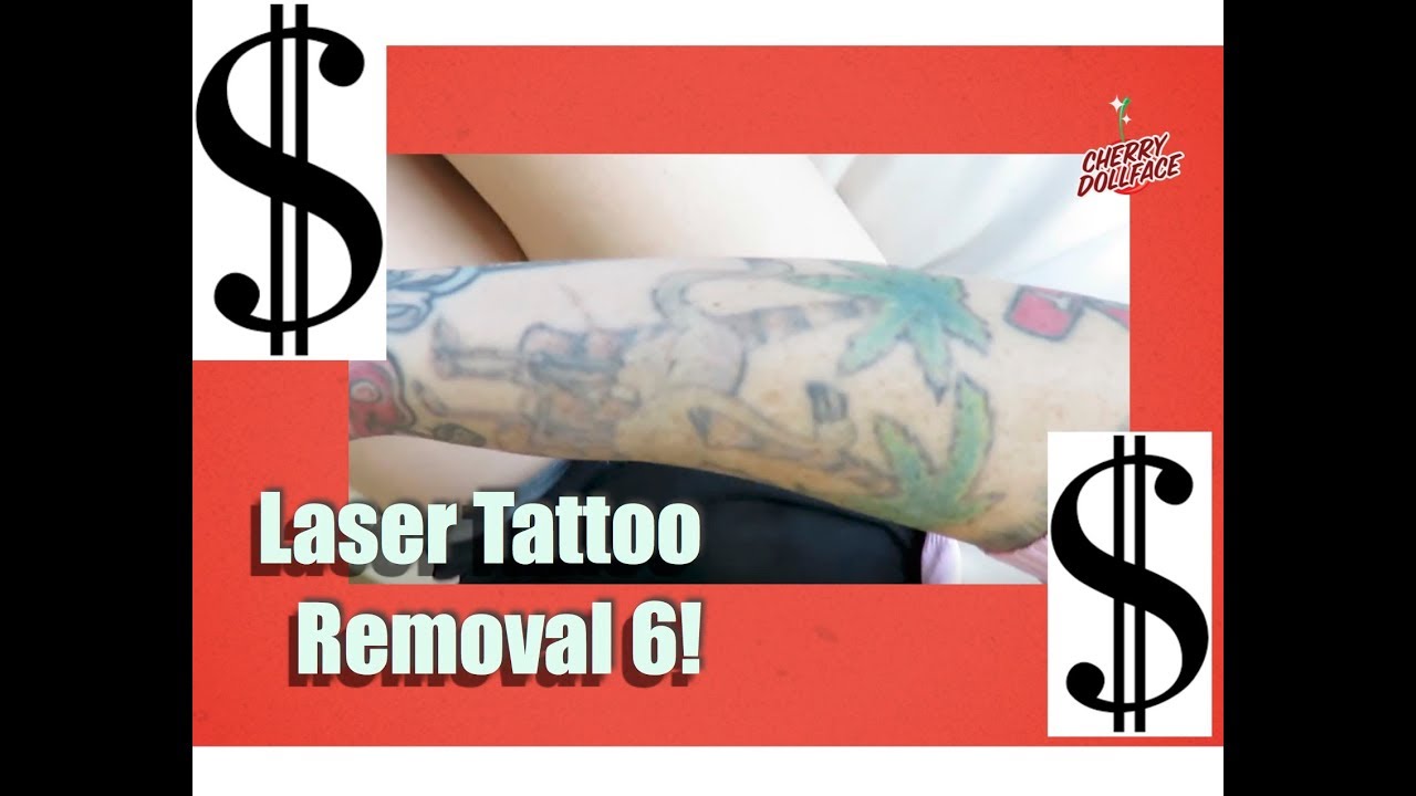 Tattoo removal progress after 25 laser sessions at 5 week intervals   rinterestingasfuck