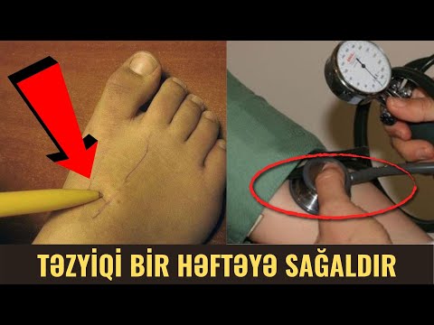 Video: Təzyiq və güc arasında hansı əlaqə var?