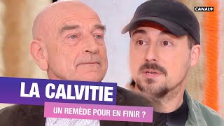 Des chercheurs ont-ils trouvé la recette miracle contre la calvitie ? La clique réagit - CANAL+