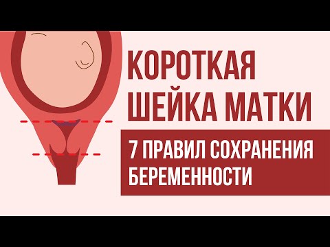 Видео: Помогает ли прогестерон при недостаточности шейки матки?