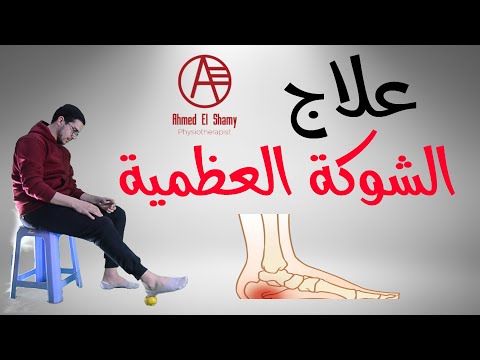فيديو: 3 طرق لشريط القدم لعلاج التهاب اللفافة الأخمصية