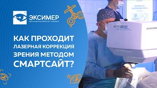 Лазерная корреккция зрения Смарт Сайт. Как проходит в офтальмологической клинике 