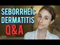 Seborrheic dermatitis Q&A with a dermatologist 🙆🤔