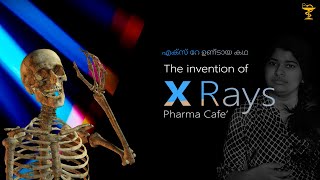 Invention of X Rays | എന്താണ് X Ray | Pharma Cafe'