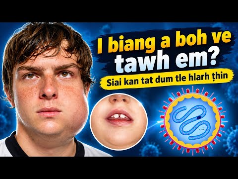 I biang a boh ve tawh em le? 