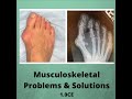 [PREVIEW] Musculoskeletal Problems &amp; Solutions - Continuing Education Course