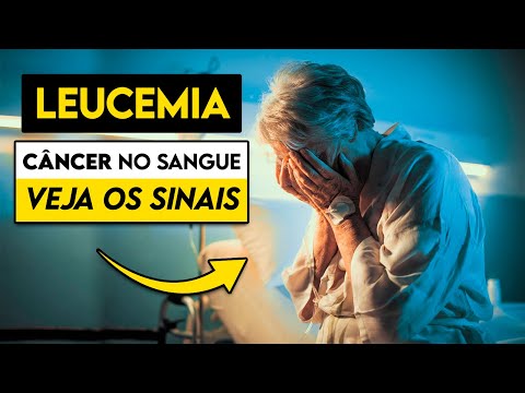 ATENÇÃO! Estes são