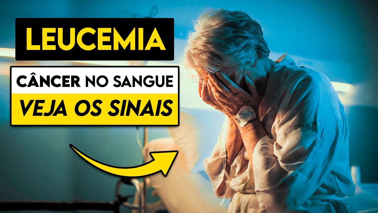 ATENÇÃO! Estes são os SINAIS de LEUCEMIAS AGUDAS │ Câncer no Sangue/Medula Óssea