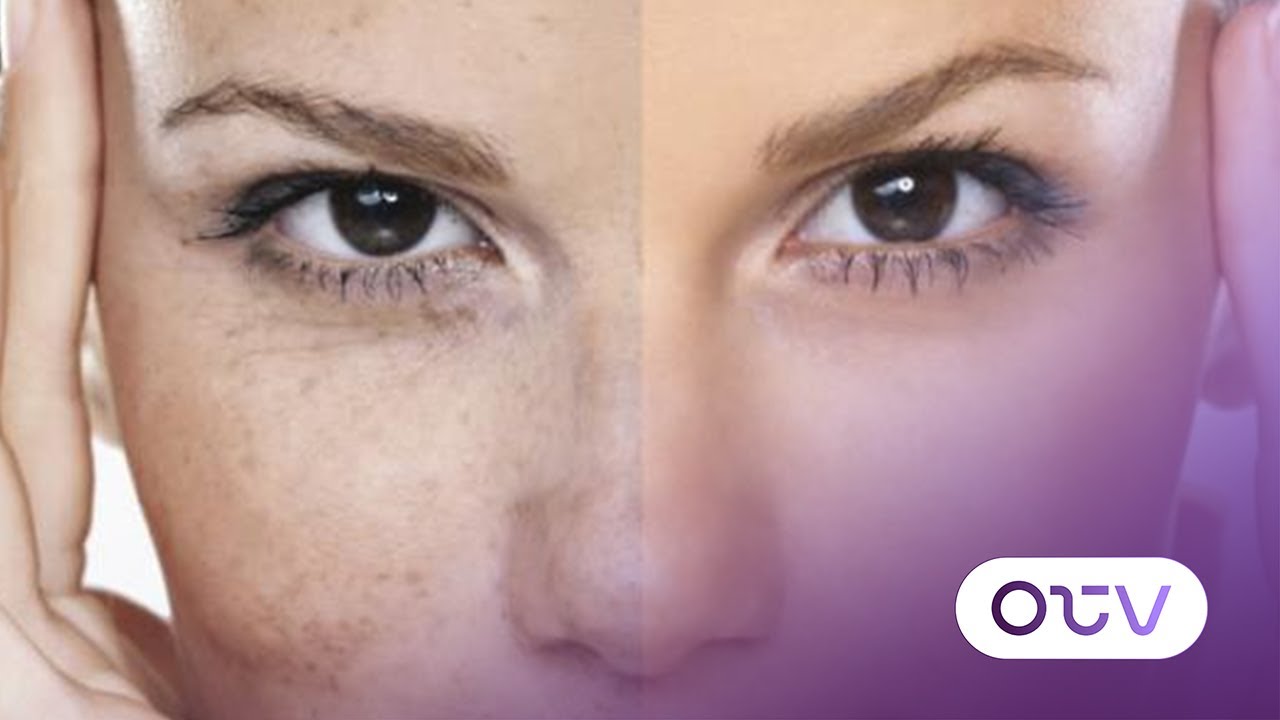 البشرة بين البرد ووسائل التدفئة: التأثيرات والحلول