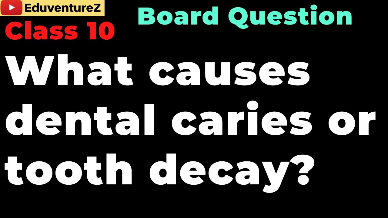 What causes dental caries or tooth decay? Class 10 Board Biology Sample