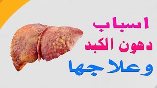 ماهي أسباب دهون الكبد او تشحم الكبد وطرق العلاج ؟