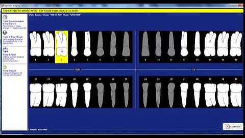 Integrating X-Ray Sensors into Dental Software | DentiMax Dental Sensor Features