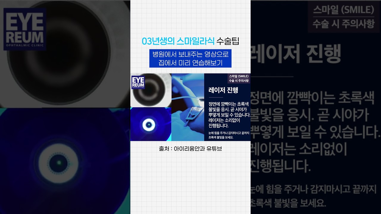 [Bệnh viện mắt Iereum] Mẹo sau phẫu thuật Smile Lasik - Quản lý Smile Lasik từ một sinh viên đại học sinh năm 2003 #IereumSmileLasik