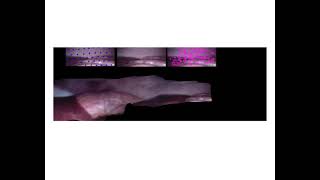 Real-time Nonrigid Mosaicking of Laparoscopy Images