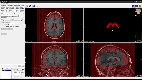 Analyze 15.0 - Segment: Subregion