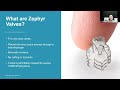 Zephyr valve 101 understanding lung valve basics