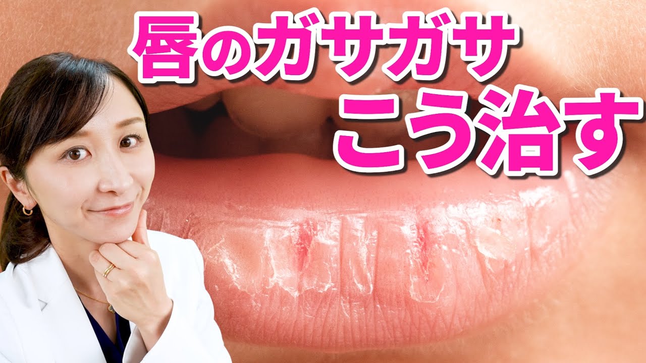 【リップでも治らない】がさがさ唇の治し方を皮膚科医が解説！