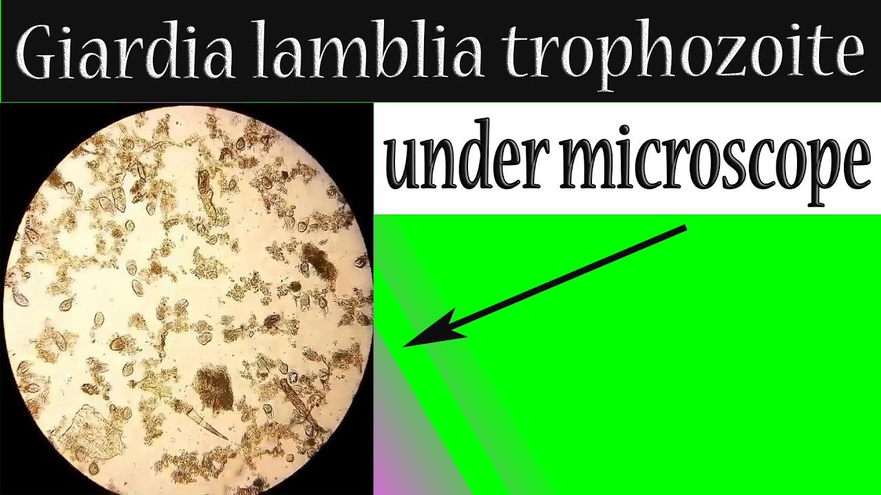 Giardia Troph