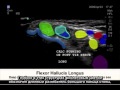 Конкретный клинический случай FujiFilm SonoSite: коленный сустав — предплюсневой канал