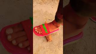  Omg   Sneakers Vs Teeth With Eyes  trend reels