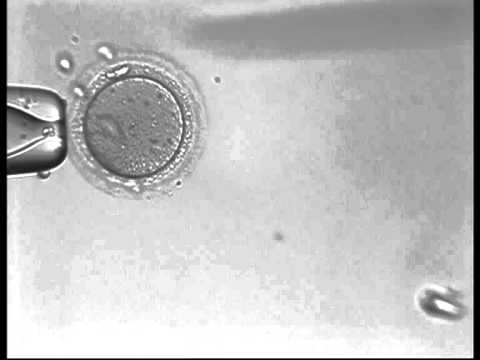 Video: Försening Av Triggning Av Oocytmognad Med En Dag Leder Till Ett Högre Metafas II-oocytutbyte I IVF / ICSI: En Randomiserad Kontrollerad Studie