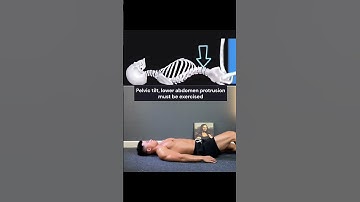 Fix Pelvic Tilt & Lower Belly Bulge with These Simple Exercises! #shorts #short