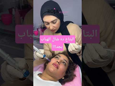 البتاع اللي بتعمله ده شال الهباب وشي لسه أحمر تعالي شوفي