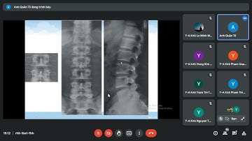 [ Thực hành ] Niệu Cột sống | Chuẩn đoán hình ảnh