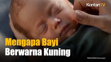 Mengapa Bayi Bisa Kuning? Ini Penyebab, Ciri-Ciri, dan Langkah Awal Mengatasinya | KONTAN Info Sehat