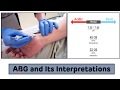 Arterial Blood Gas (ABG) Analysis || Arterial Blood Gas (ABG) Interpretations In 3 Easy Steps