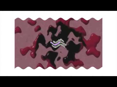 Asleep Klasky Csupo Effects 2