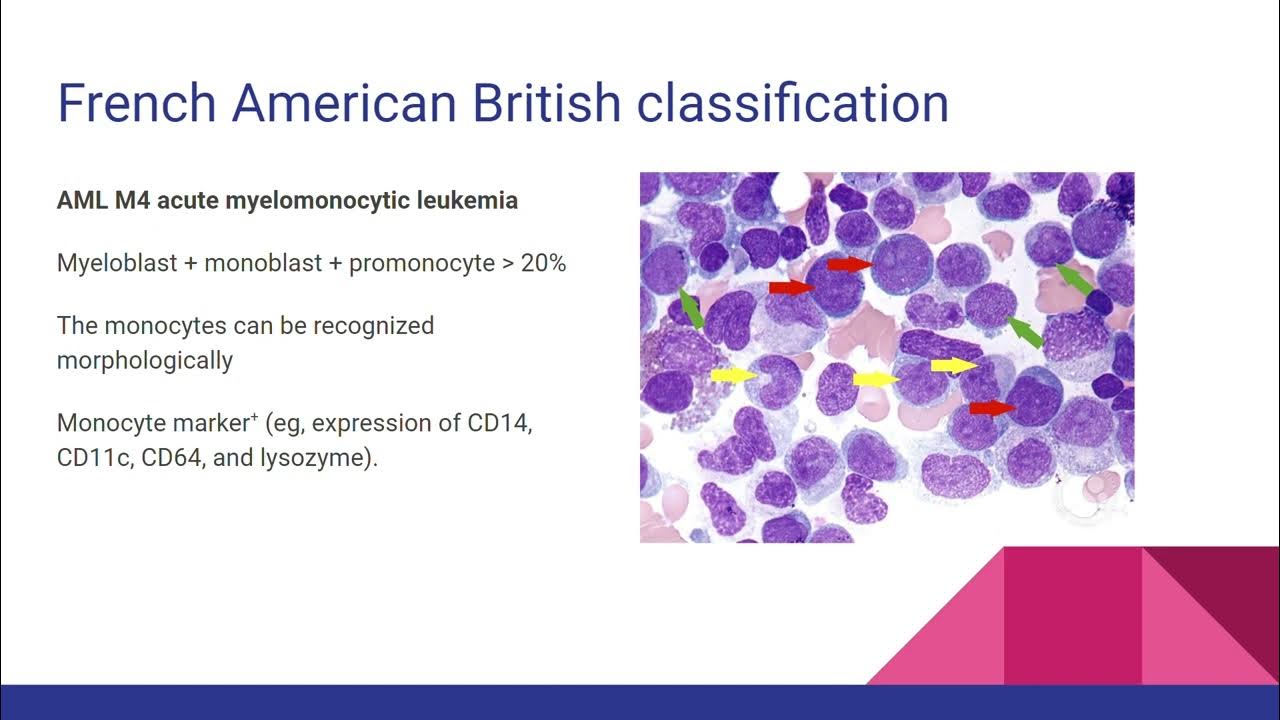 Hematologic malignancy for medical student YouTube