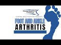 All about foot  ankle arthritis