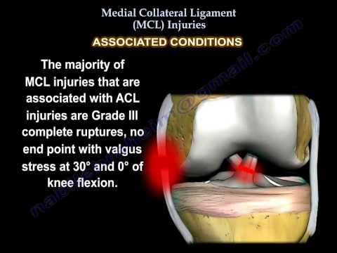 Medial Collateral Ligament injury , MCL Injuries - Everything You Need To Know - Dr. Nabil Ebraheim