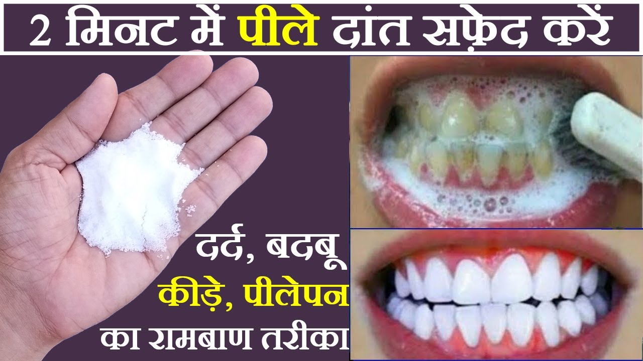 गंदे पीले दांतों को सफेद कैसे करे, gande dant kaise saaf karen, teeth ...