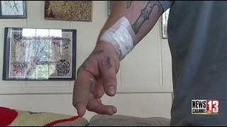 Beaver attack survivor recalls fight with animal in Lake George