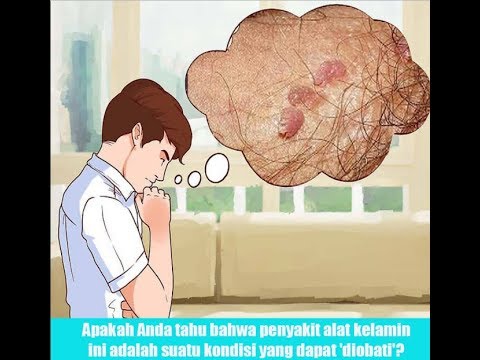 resep-obat-kutil-kelamin