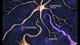 Interactive Software #parkinsons screenshot 1