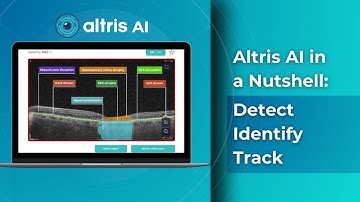 How AI for Geographic Atrophy on OCT works: Hypertransmission Example