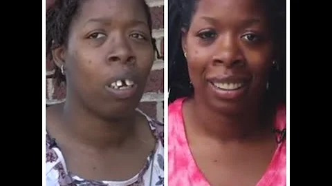 Cyber-bullied woman gets new smile