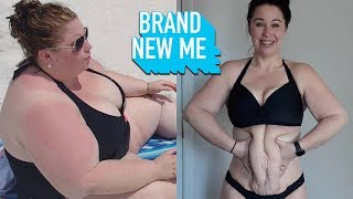 I Lost 230lbs But Can Surgery Fix My Excess Skin? | BRAND NEW ME