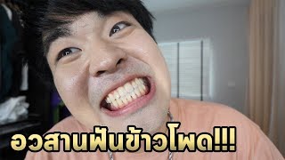 ฟันผมไม่เป็นข้าวโพดแล้วครับ!!!