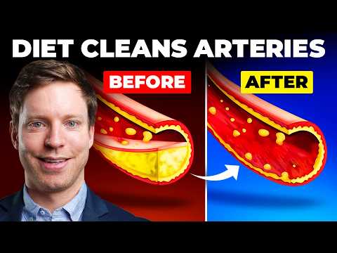 Best Diet to