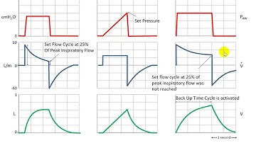 Principles of Mechanical Ventilation: Control Variables, Phase Variables, and Breath Types