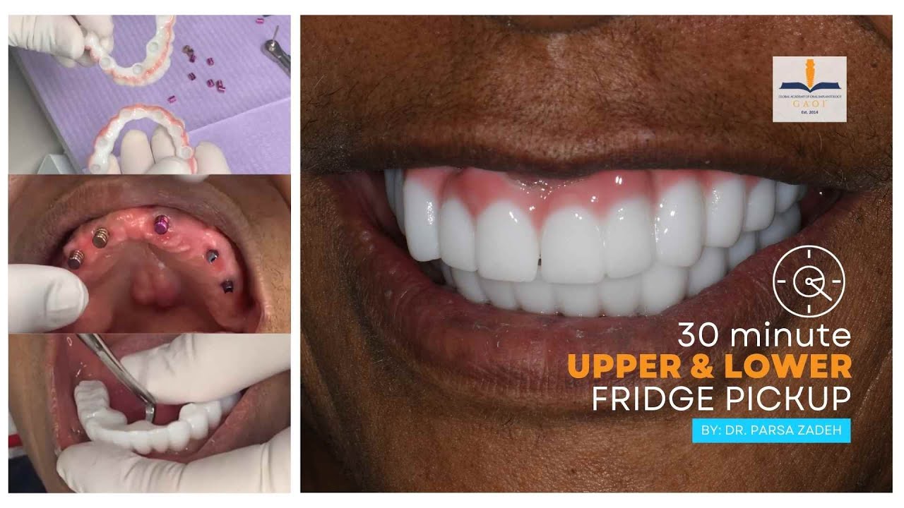 30 Minute Upper & Lower Fridge Pickup YouTube