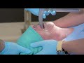 3.0 Oral Intubation - TNS Trauma Procedure Video Series
